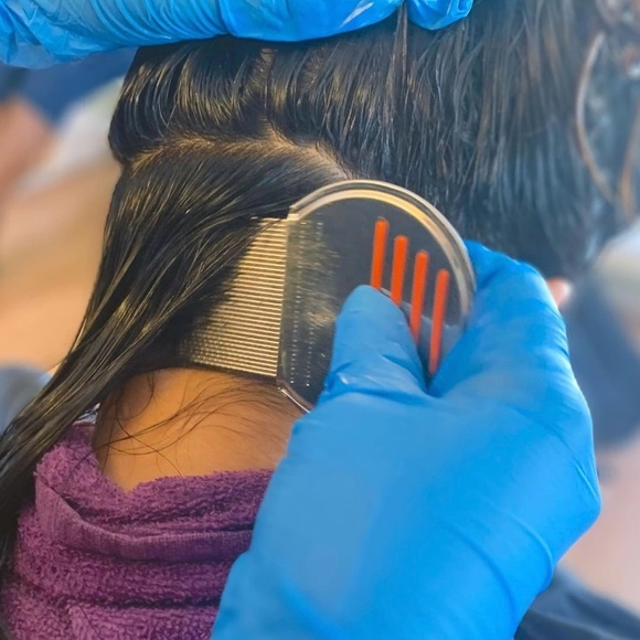 Nit Free Terminator Comb - Picture 5 of 8